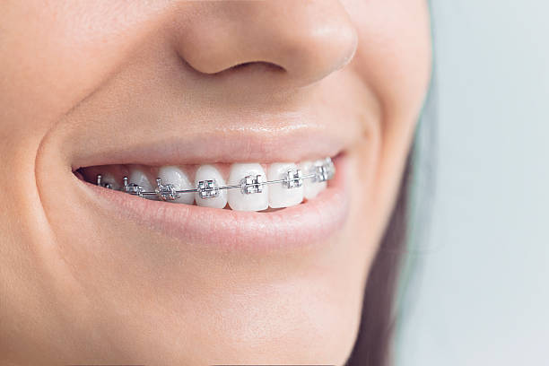 Best Dental Inlays and Onlays  in Racend, LA